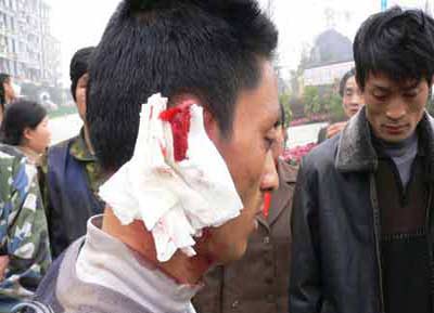 必一:逃跑吧少年肾上腺素 肾上腺素使用技巧(图1) b体育